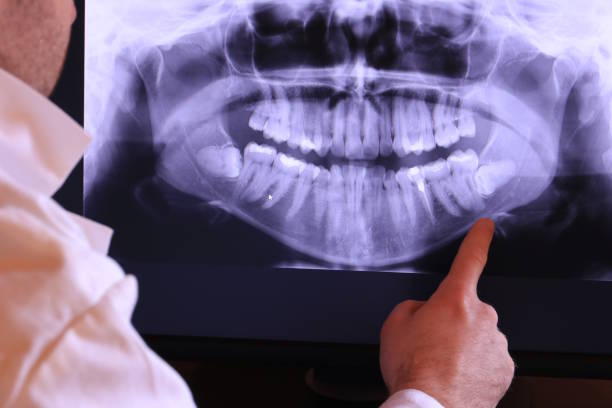 Best Emergency Treatment for Oral Infections in Amherst, OH